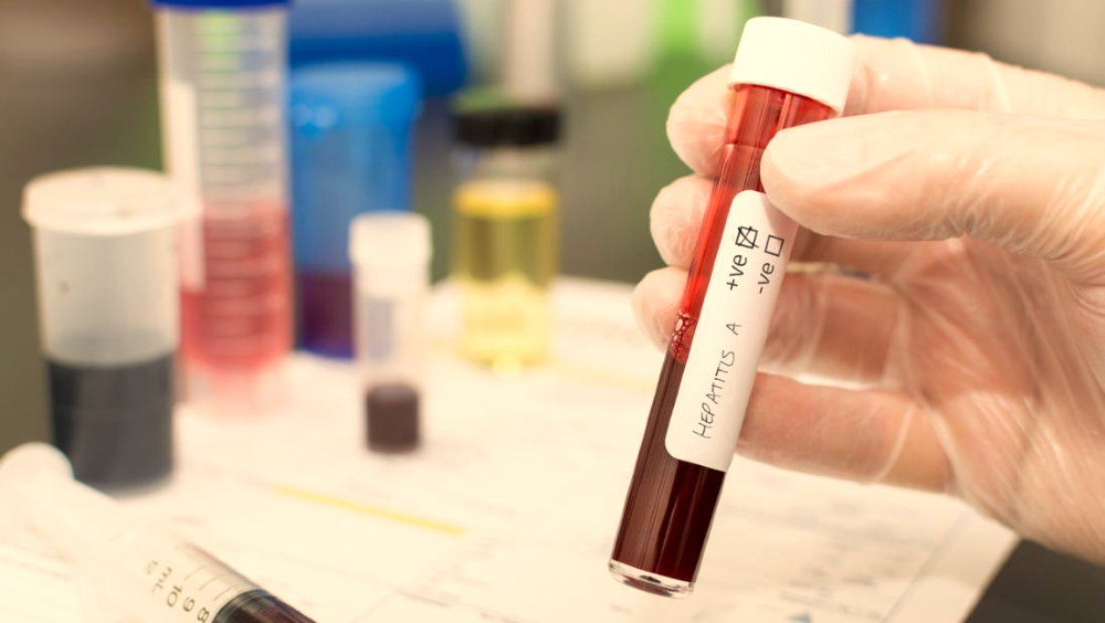 hepatitisa.jpg